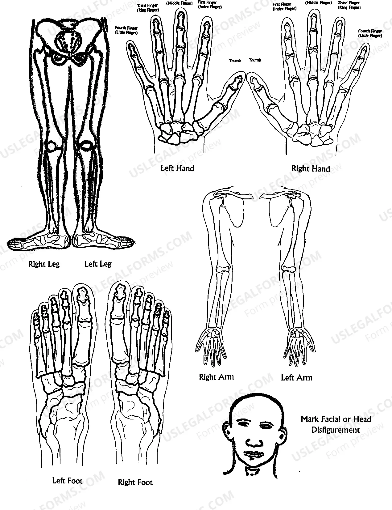 Preview Workers Compensation Medical Report