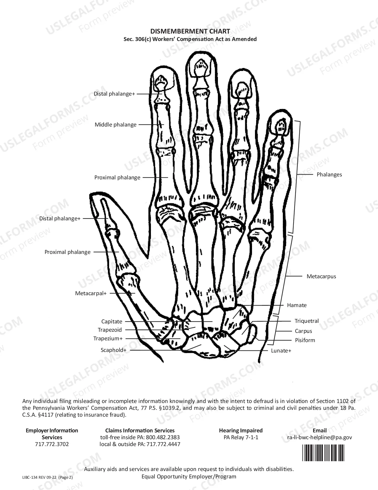 Preview Dismemberment Chart