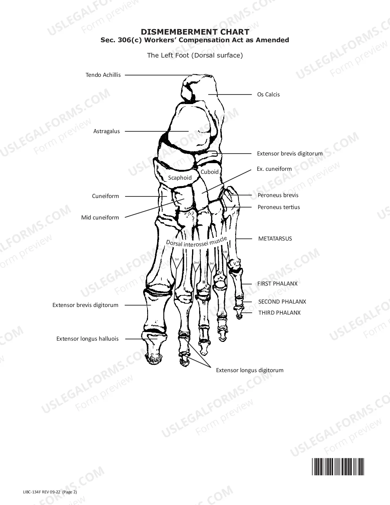 Preview Dismemberment Chart (Foot)